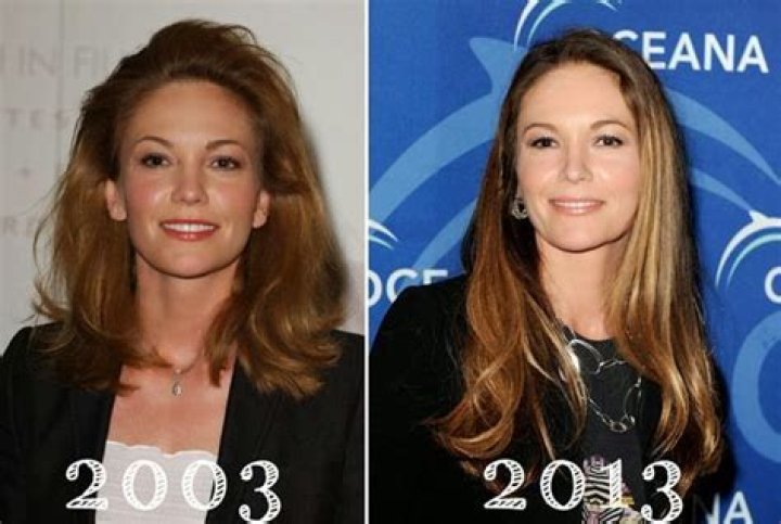 Diane Lane Breast Implants Plastic Surgery Before and After
