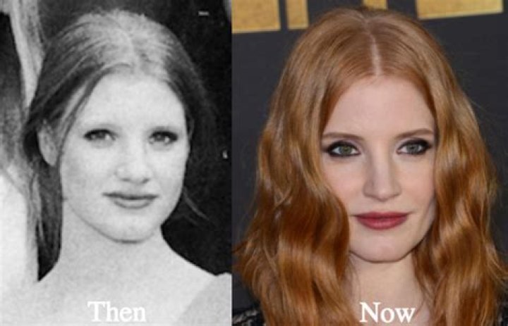 Jessica Chastain Plastic Surgery Before and After