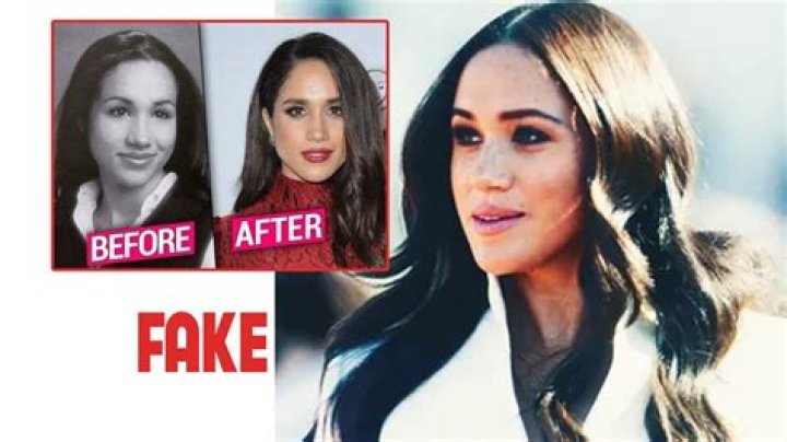 Katharine McPhee Breast Augmentation Plastic Surgery Before and After