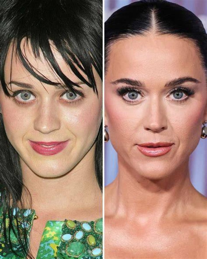 Katy Perry Plastic Surgery Before and After