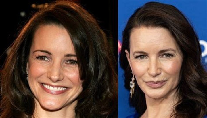Kristin Davis Plastic Surgery Before and After