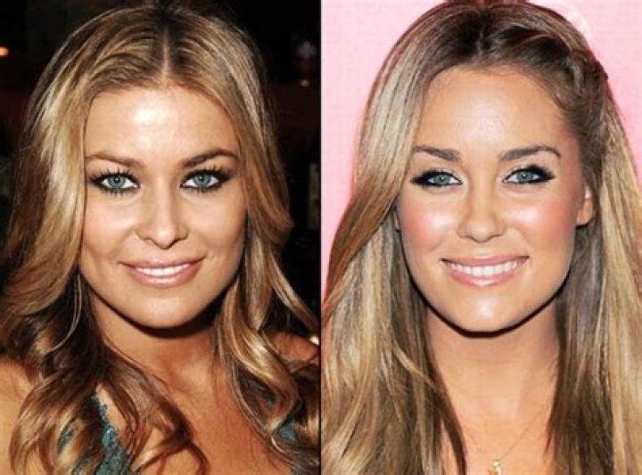 Lauren Conrad Plastic Surgery Before and After
