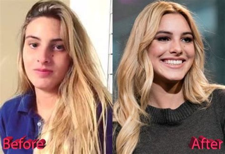 lele pons nose transformation