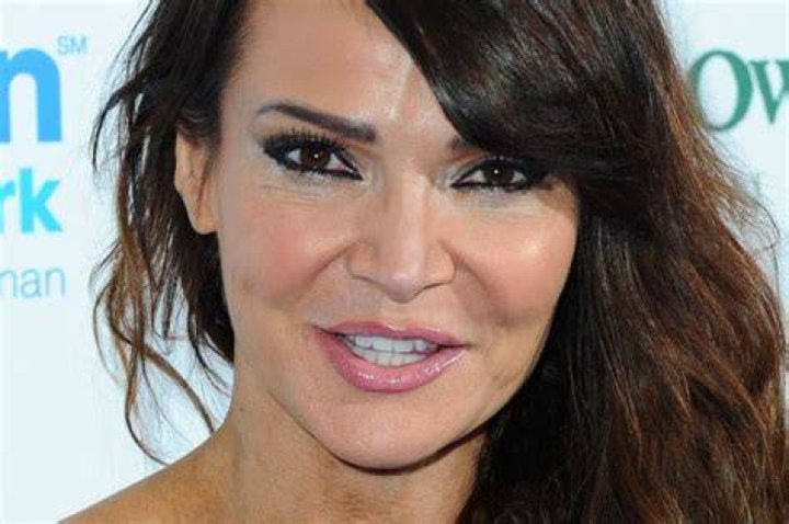 Lizzie Cundy Plastic Surgery: What Type of Surgeries Has She Done?
