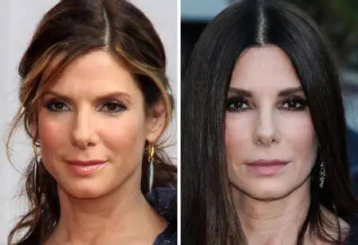 Sandra Bullock Plastic Surgery Before and After