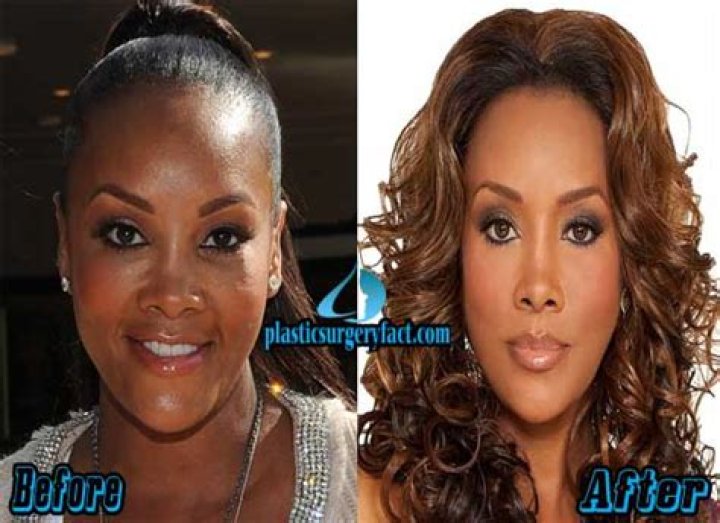 Vivica Fox Breast Implants Plastic Surgery Before and After